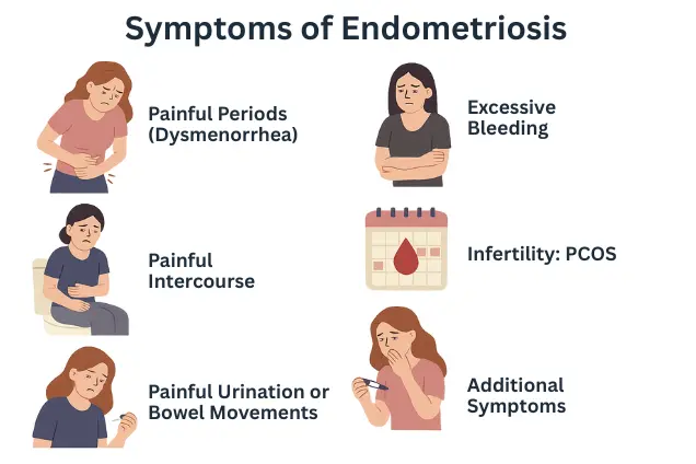 Symptoms of Endometriosis